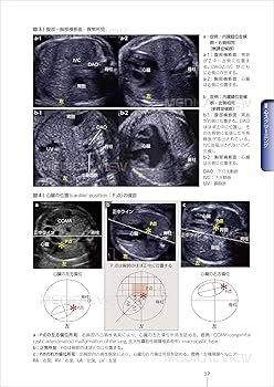 胎児心エコーのすべて−スクリーニング・精査・治療・そして家族支援